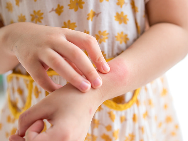 アレルギー専門看護師による丁寧なサポート